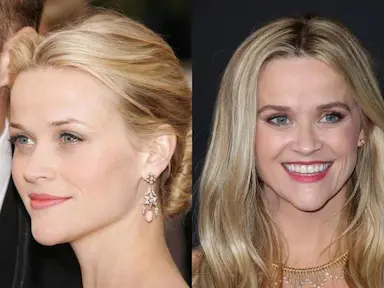 Pointy Chin: Everything you need to know.