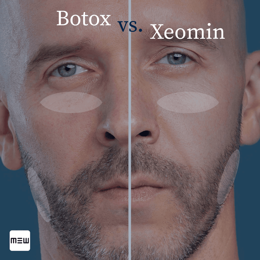 BotoxvsXeomin