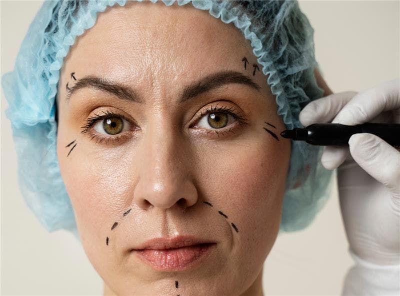 How long does Botox last?